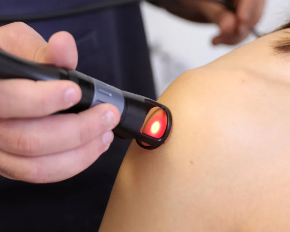 Trattamento Laser Yag ad alta potenza a Ispica